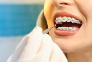 braces-orthodontist-portage-park
