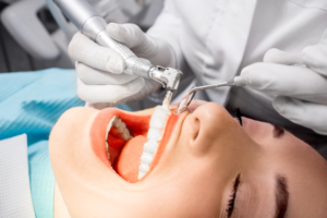 Teeth cleaning by a dentist at a dental office in Jefferson Park, Chicago