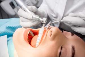 Professional teeth cleaning by a dentist in Jefferson Park, Chicago