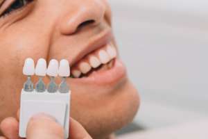 Professional teeth whitening at a dental office in Edison Park, Chicago